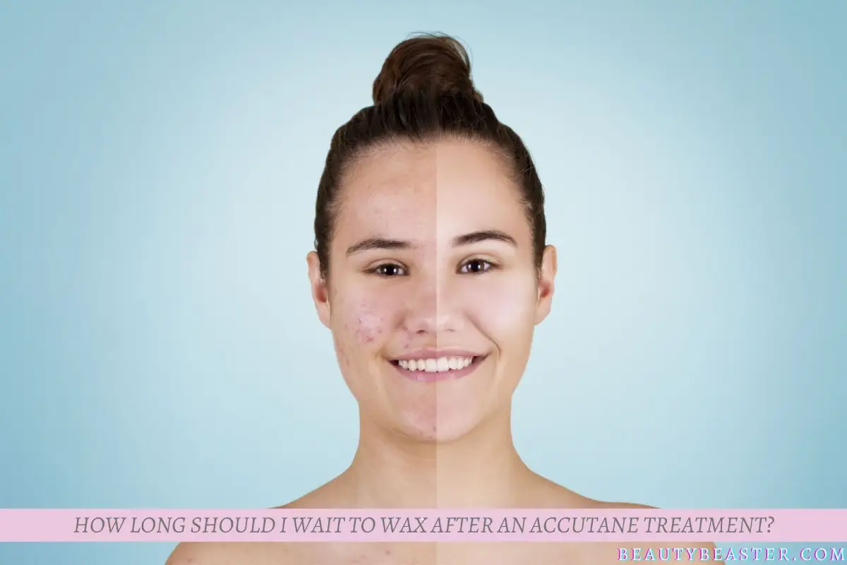How Long Should I Wait To Wax After An Accutane Treatment?