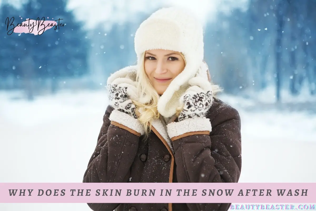 Why Does The Skin Burn In The Snow After Wash